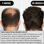 AlphaInfuse™ Hair Regrowth System - Image 3
